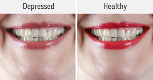 Depression Affects Color Perception