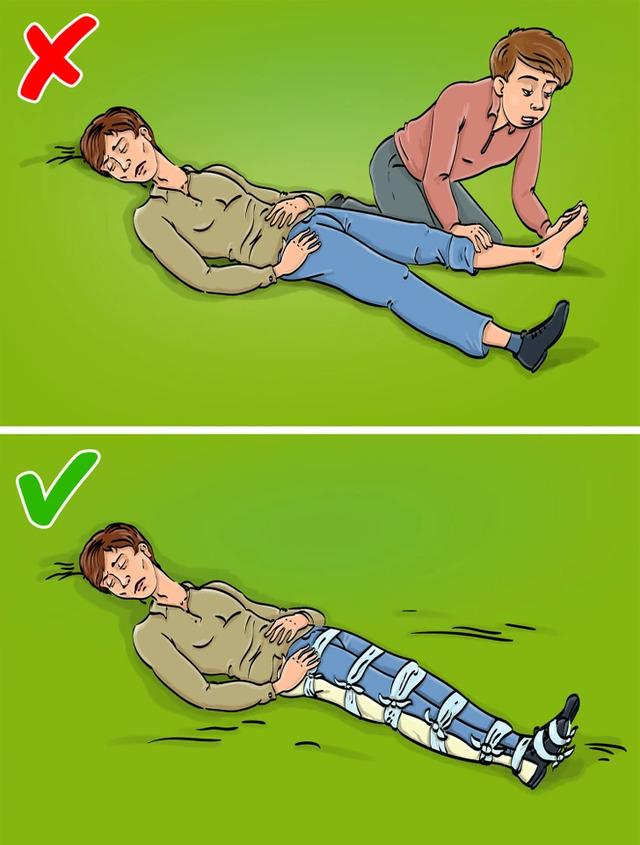 Snakebites: Do Not Suck the Venom