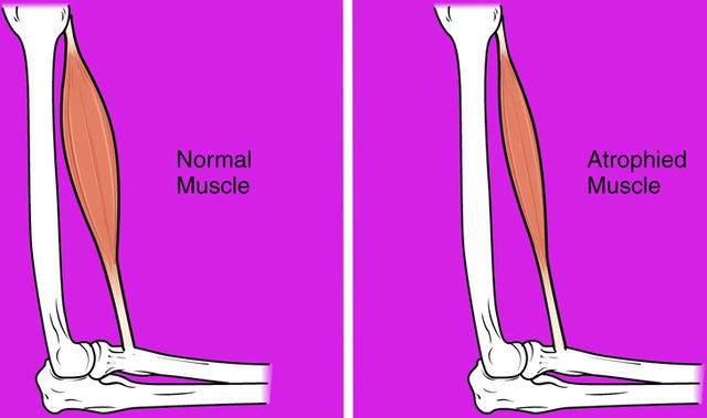 In microgravity, muscles experience less weight, causing astronauts to lose up to 20% of muscle mass in just 5 to 11 days without regular use.