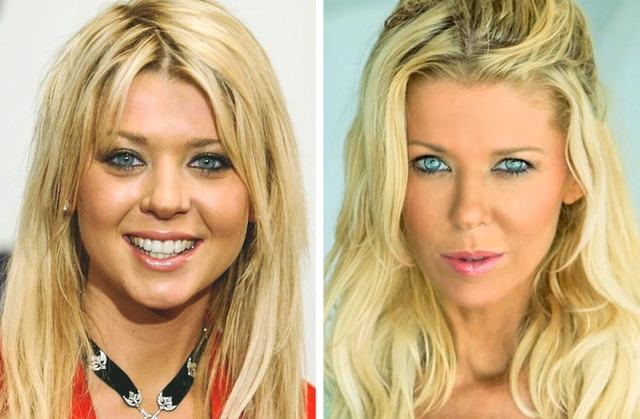 A striking comparison of Tara Reid from her early "American Pie" days to her recent appearance.