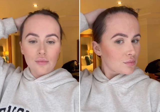 Beth’s forehead, which she had always felt was too large in comparison to her face, became a symbol of all her insecurities