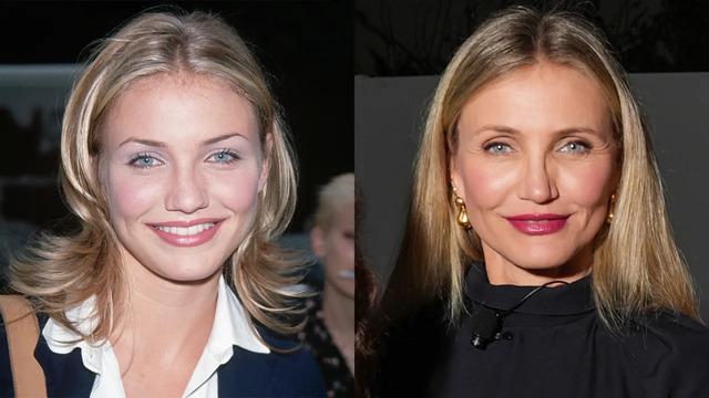 Cameron Diaz’s brief experiment with Botox and her decision to embrace aging naturally.