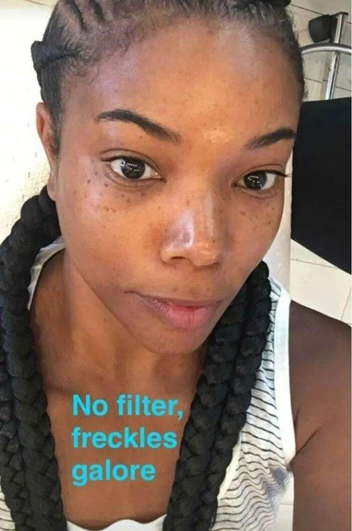 Gabrielle Union: Showing Off Her Freckles with Pride
