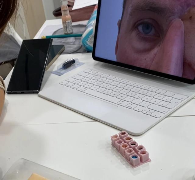 He sought a more creative solution, looking beyond the typical prosthetic eye.