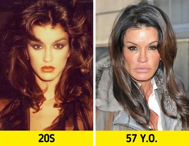 Janice Dickinson: The Supermodel’s Changing Looks