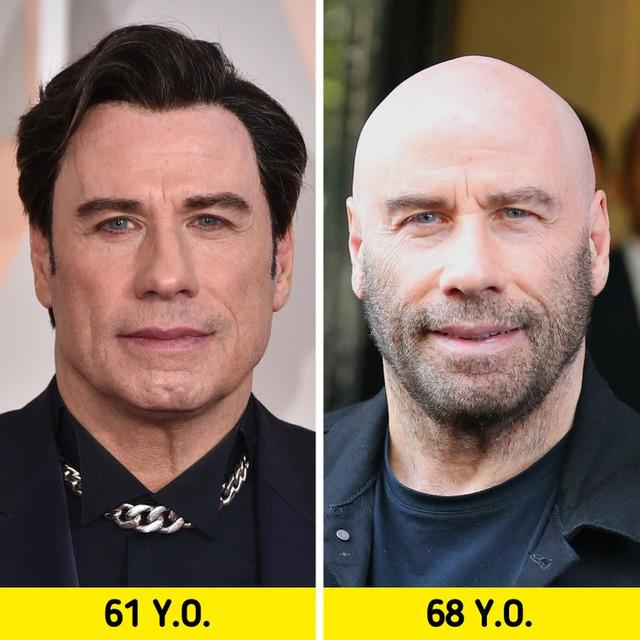 John Travolta: From Grease to The Bald Look