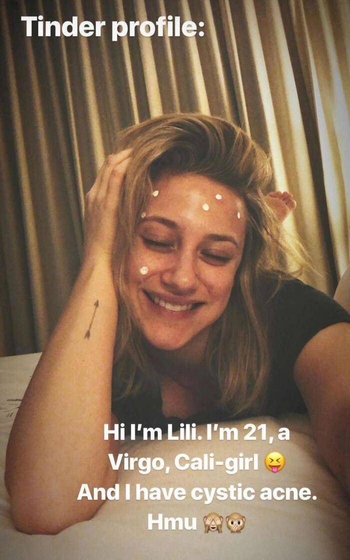 Lili Reinhart: Joking About Her Struggle with Cystic Acne