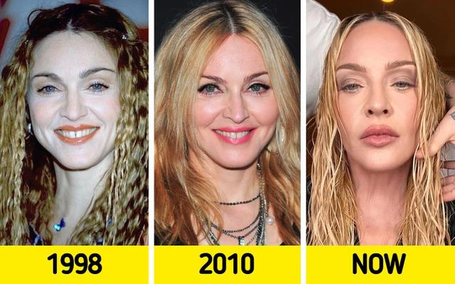 Madonna: The Price of Perfection