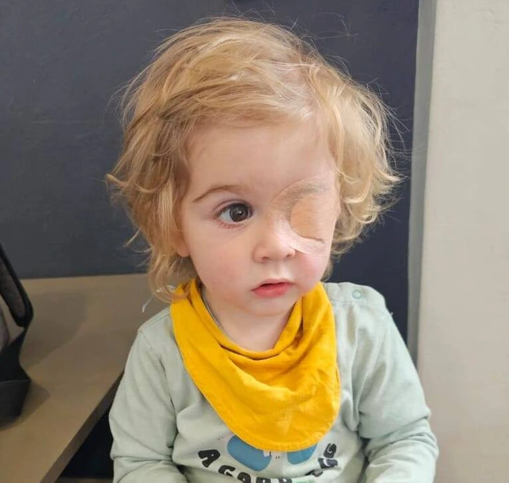 The family remains hopeful the child’s eye may heal, but they acknowledge the risk of permanent sight loss in the left eye.