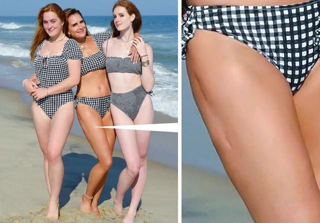 The photoshoot was beautiful, but there was something else that caught fans’ attention—a visible scar on Brooke’s leg