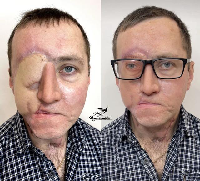 The tattoo session became a pivotal moment in his long road to recovery.