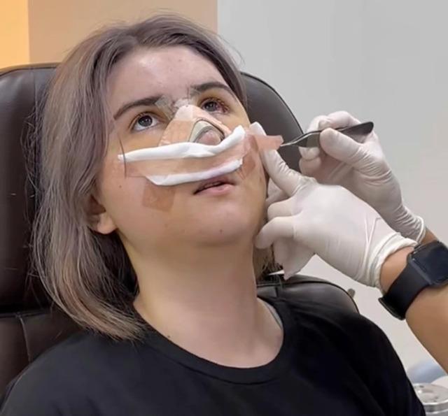 The woman receiving post-surgery treatment with medical staff adjusting her bandages after the procedure.