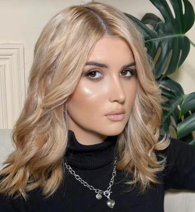 The woman six months after her surgery, showing the final results of her transformation with her updated look and style.