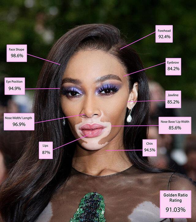 5th Place: Winnie Harlow – The New Breed of Supermodels