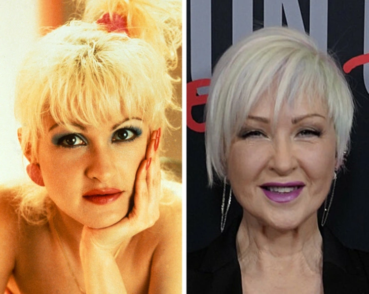 Cyndi Lauper: The Iconic Voice and Style of the ’80s