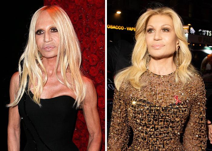 Donatella Versace: The Fashion Icon’s Glowing New Look Sparks Debate