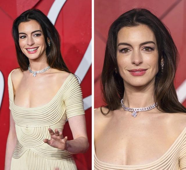 It’s also important to recognize that Anne Hathaway, like many other women in Hollywood, is not immune to the pressures of society’s beauty standards.