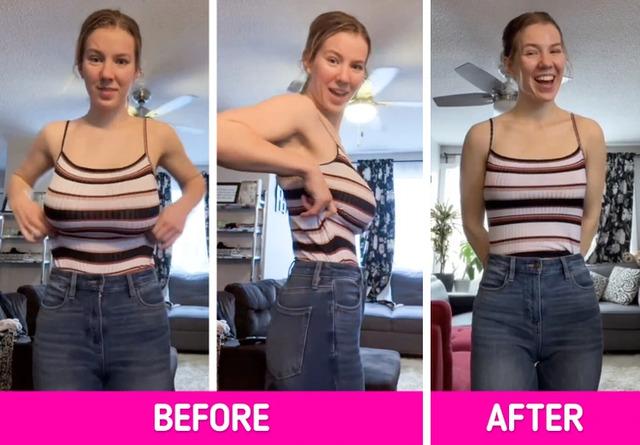 Janel didn’t just show the glamorous before-and-after shots but also gave insight into the recovery