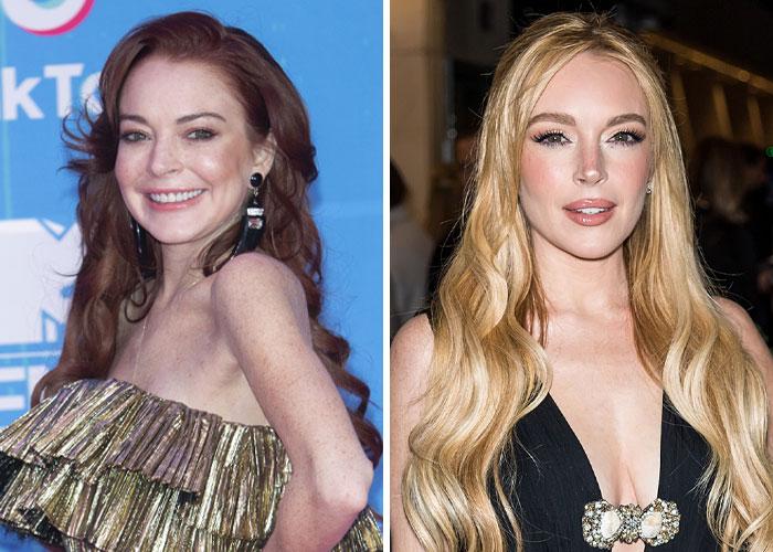 Lindsay Lohan: From Freckles to Glowing Skin – What’s Behind the Change?