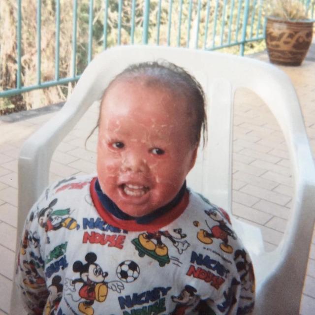 Mui was born in China, a place where the understanding and resources to support her condition were limited