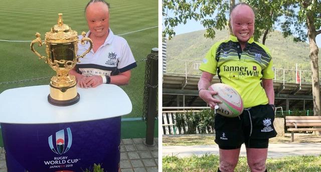 Mui’s parents always hold onto hope, supported by her remarkable health and progress