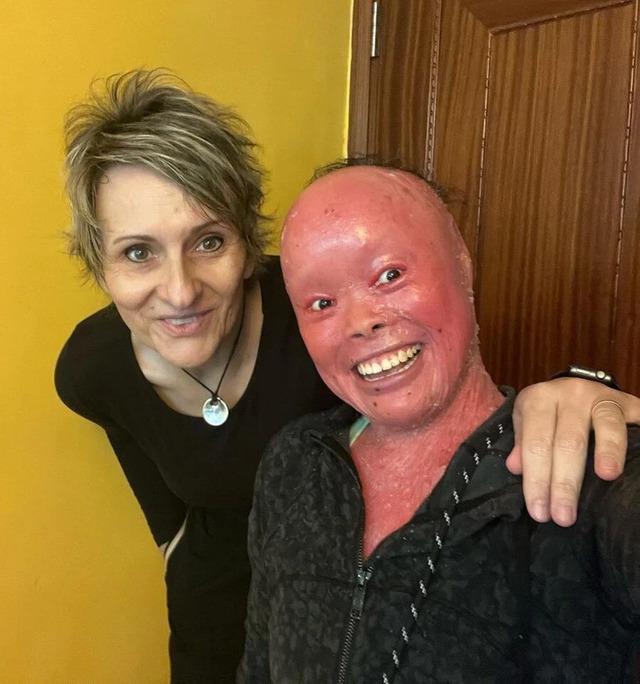 Now in her thirties, Mui continues to defy expectations with grace and courage.