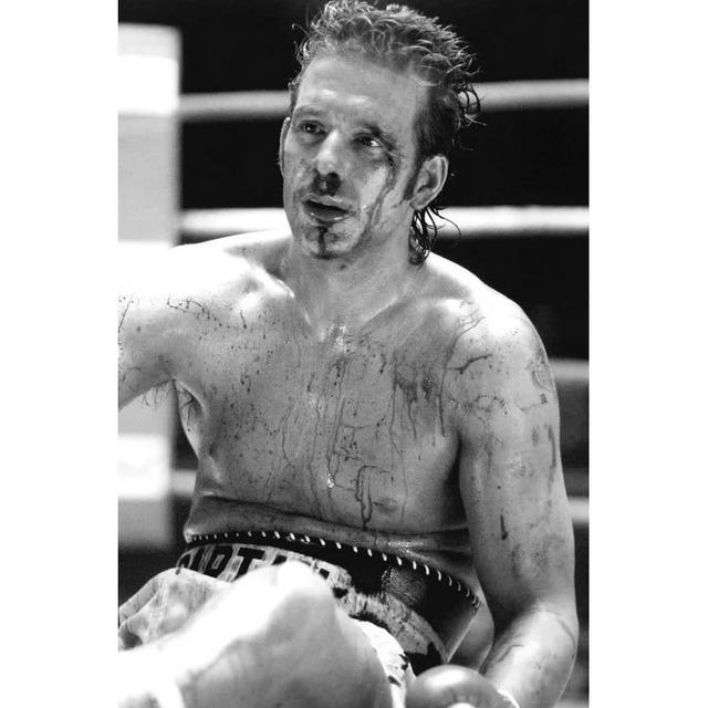 Over the years, Rourke suffered numerous injuries that would later haunt him.