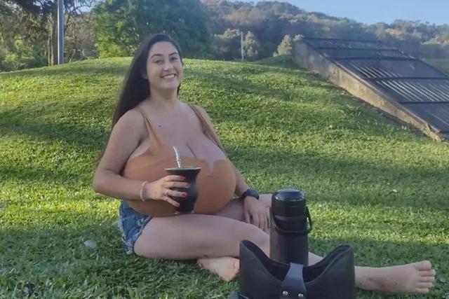 Thaynara Marconde lives with gigantomastia, a rare medical condition that caused her breasts to grow to an overwhelming 22 pounds 