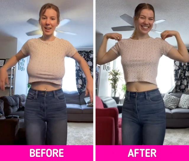 The surgery wasn’t just a cosmetic decision; it was a life-changing one, allowing her to embrace a new, healthier version of herself.