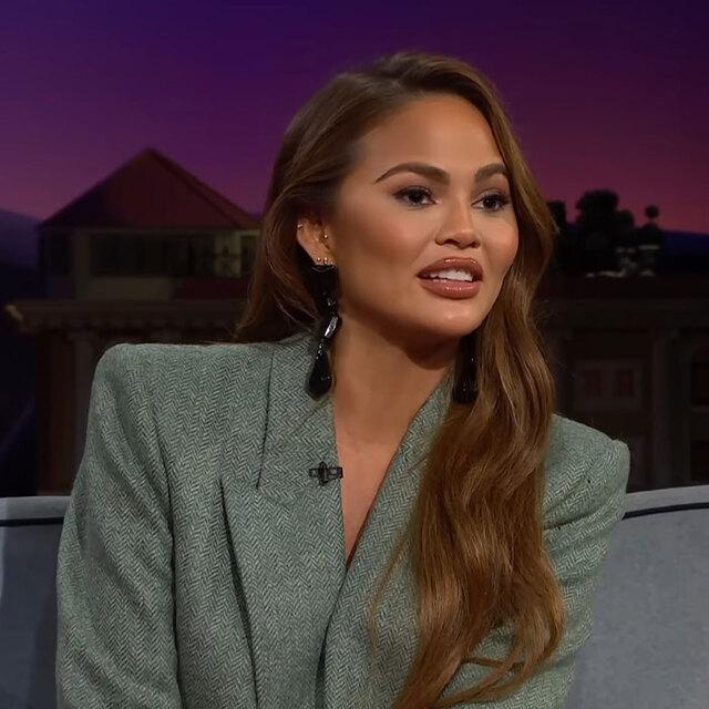 Chrissy Teigen Reveals Her Buccal Fat Removal Experience