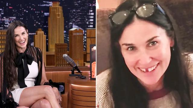 During a 2017 appearance on The Tonight Show Starring Jimmy Fallon, Demi revealed that her two front teeth had fallen out.