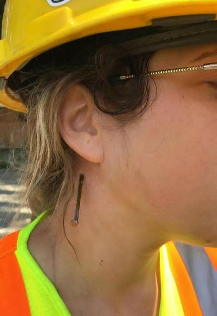 Girlfriend Got Injured at Work and Needed Medical Help