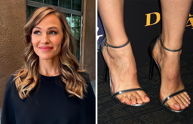 Jennifer Garner’s Overlapping Toes: A Genetic Quirk with No Impact on Style