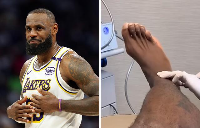 LeBron James’s “Traveling Toes”: Athleticism Meets Unique Physiology