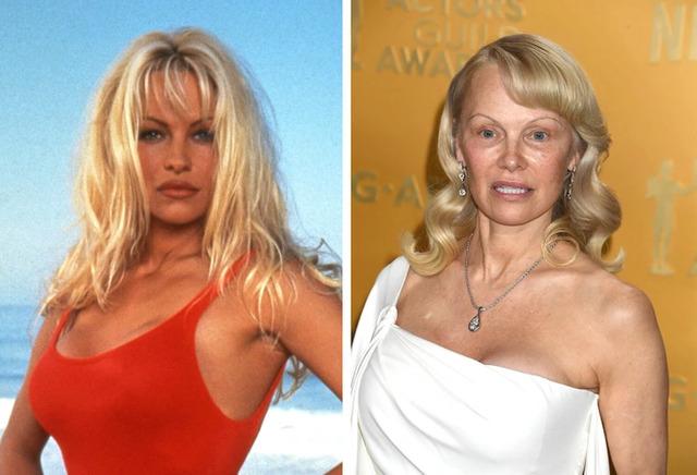 Pamela Anderson: A Baywatch Icon’s Bold Reinvention