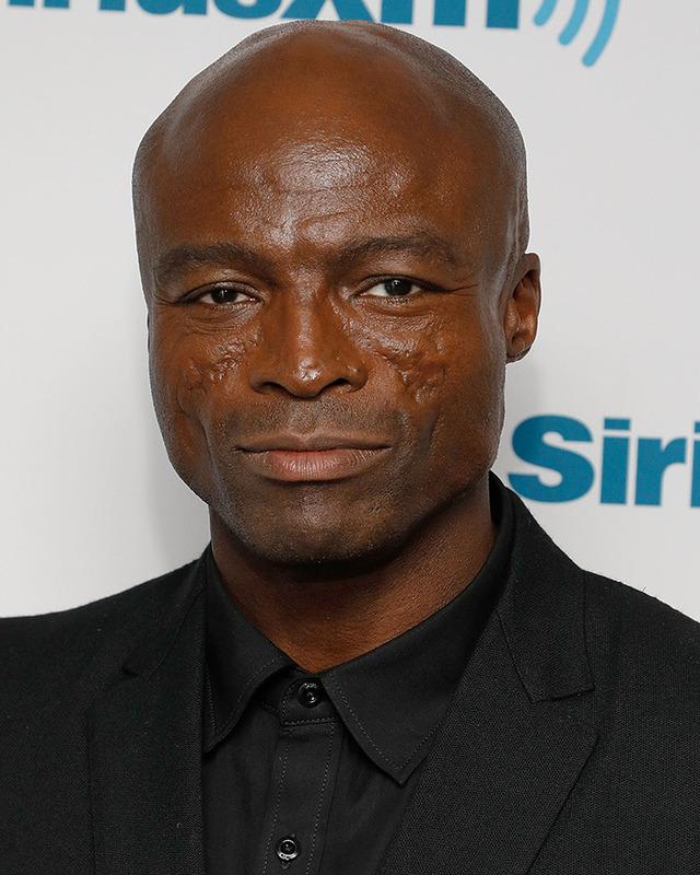 Seal’s Facial Scars: Turning Discoid Lupus Into a Signature Look 