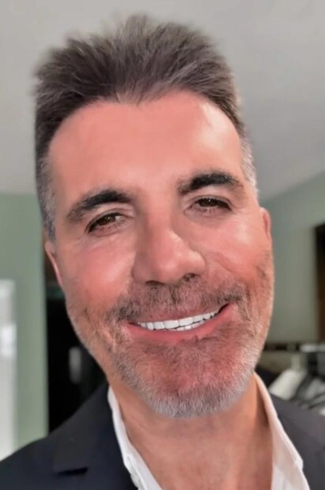 Zooming in, social media users noticed his cheeks appeared unnaturally full, his skin noticeably tight, and his smile seemed almost strained.