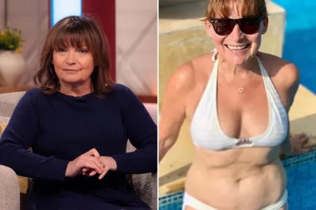 A true inspiration, Lorraine’s genuine smile reminds us all that beauty is about joy and authenticity.