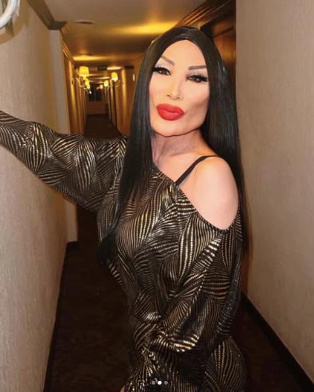 According to reports, a close friend, motivated by envy rather than care, urged Lyn to undergo cosmetic enhancements.