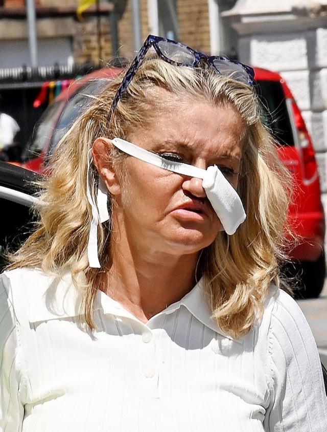 In an age obsessed with instant perfection, Danniella’s choice to document and share the unvarnished truth of her surgery and recovery stands out