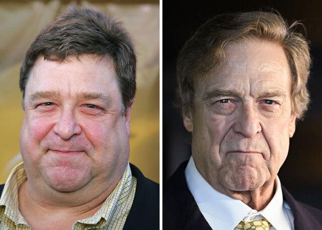 John Goodman: A Cautionary Tale of Facial Volume Loss
