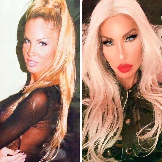 Over 20 years, she spent millions on surgeries like breast augmentations, nose jobs, facelifts, and voice therapy.
