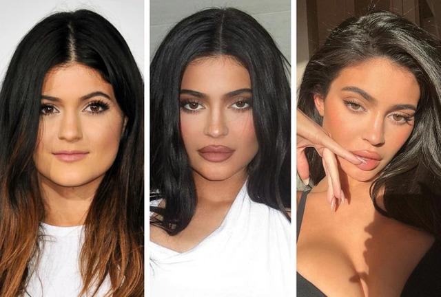 Rumors and discussions about cosmetic procedures have followed her for years, making her a frequent subject of media and public scrutiny