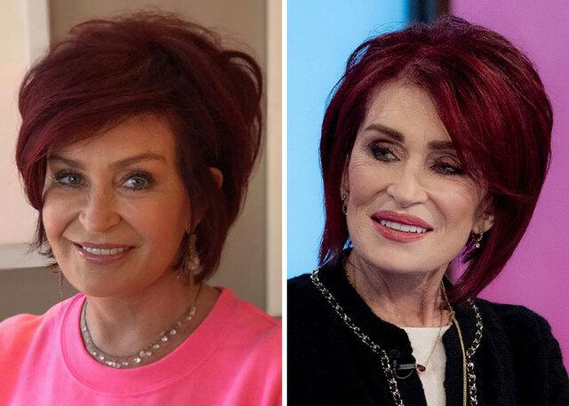Sharon Osbourne: An Extreme Example of Ozempic Face
