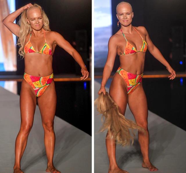 That same year, professional dancer Christie Valdiserri bravely embraced her alopecia areata, walking the runway with inspiring authenticity.