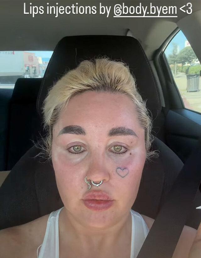 Amanda has openly shared how deeply her insecurities about her looks shaped her sense of self.