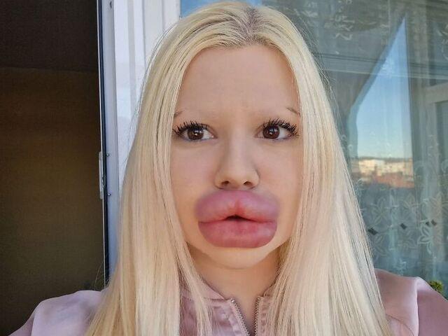 Andrea’s extreme journey has not gone unnoticed by medical professionals