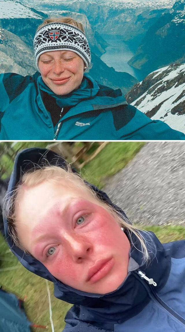 Burnt by Snow Reflection on a Cloudy Day