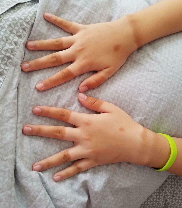 Cousin’s Neat Biking Glove Tan Lines