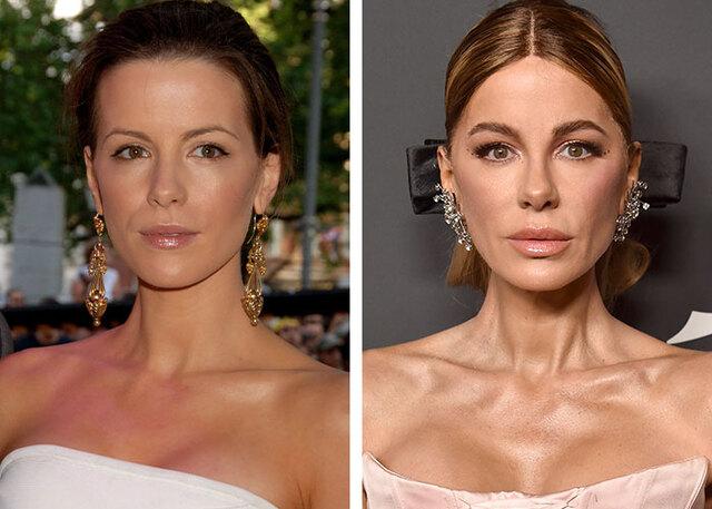 Kate Beckinsale pushes back against beauty bullying, standing firm against unfair assumptions.